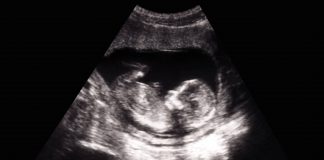 Derecho al exterminio: por qué el aborto no es (ni puede ser) una prestación sanitaria Aborto
